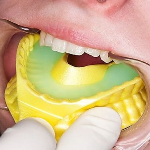 Fluoride Application in J P Nagar