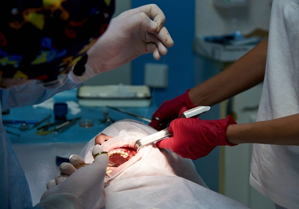 surgery-in-a-dental-clinic-2021-09-02-02-46-55-utc (1)