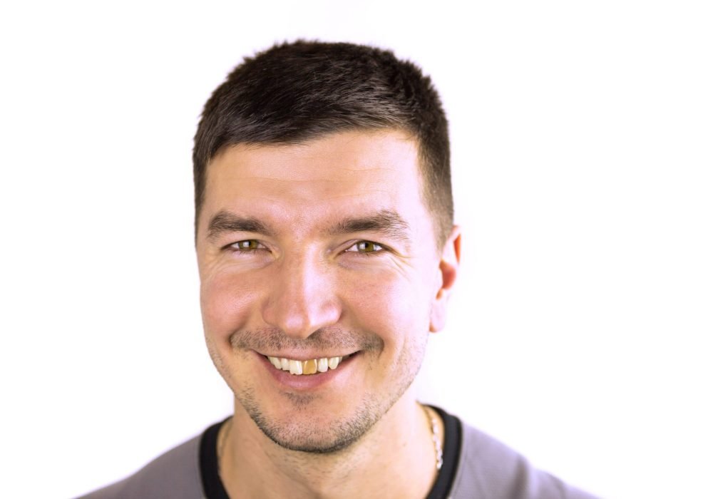 yellow-damaged-tooth-of-a-smiling-caucasian-man-in-2022-01-10-21-37-16-utc (1)